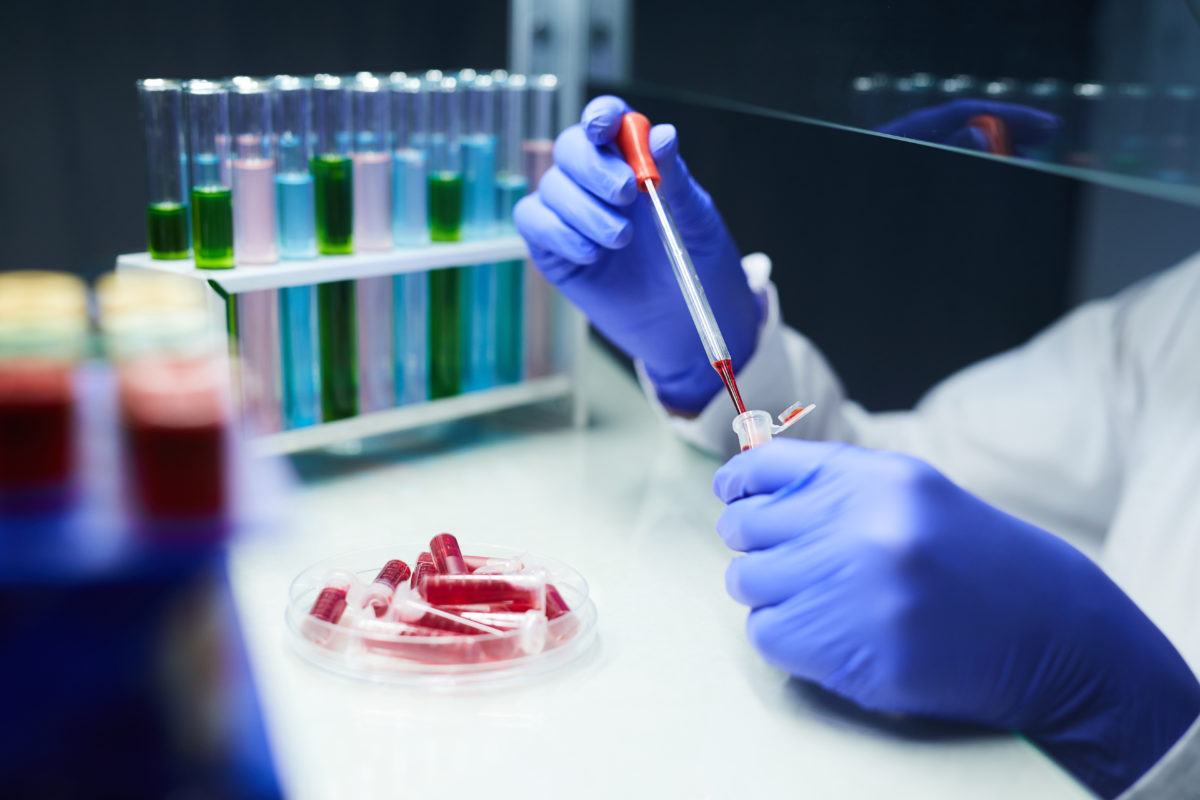 Мышьяк в крови: исследования в лаборатории kdlmed