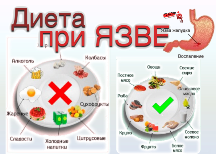 Dieta hepatica alimentos prohibidos