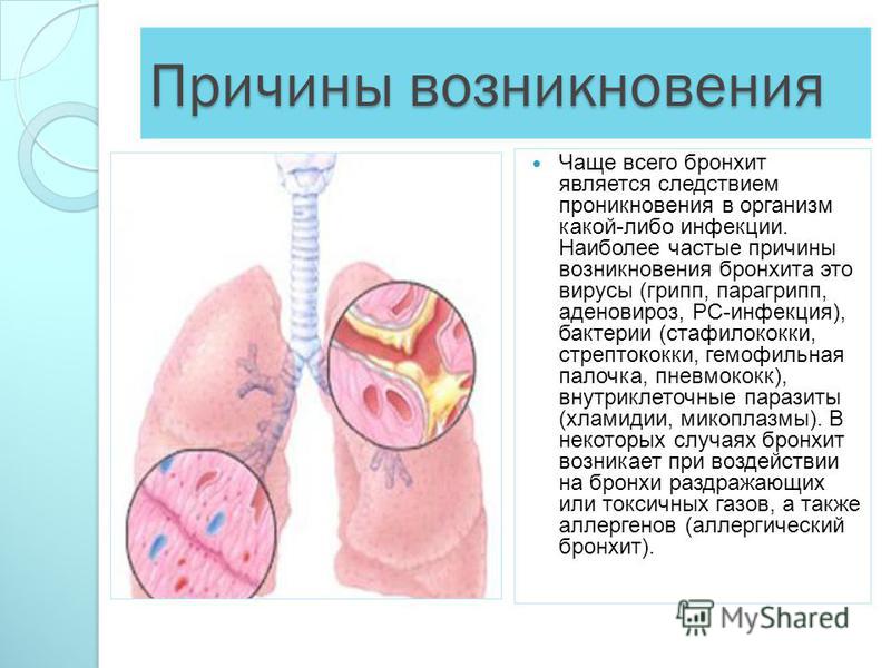 Диета при бронхиальной астме: гипоаллергенный рацион для взрослых людей, особенности питания детей, таблица разрешенных продуктов