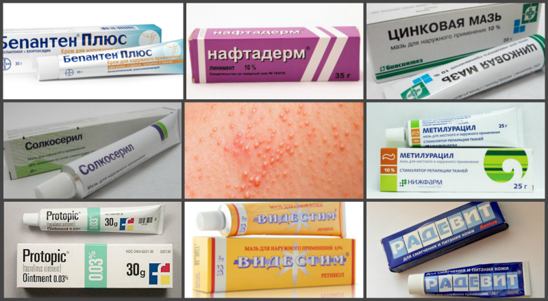 Ланолин (е913): свойства, чем полезен для лица, бровей, при аллергии, атопическом дерматите у детей, отзывы о лечении пигментных пятен на теле