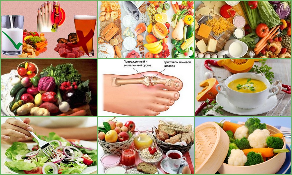 Диета и правильное питание при артрозе | «здравствуй»